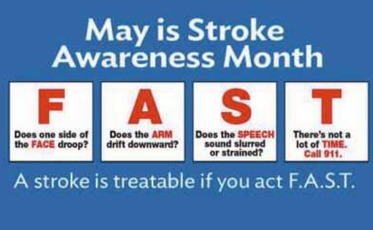 Suspect stroke? Think FAST